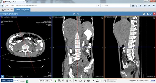 pacs, pacs software, tele radiology, tele radiology pacs, tele radiology software, teleradiology, teleradiology pacs, teleradiology software, radiology pacs, radiology pacs software, hospital pacs, hospital pacs software, radiology pacs india